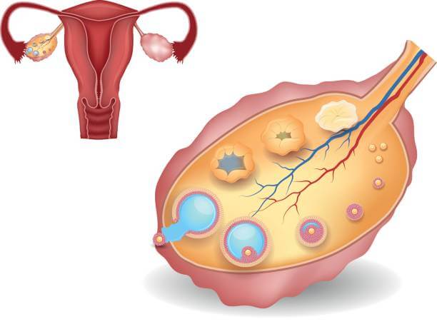 What is a uterine vibration